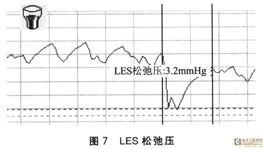 LES松弛壓