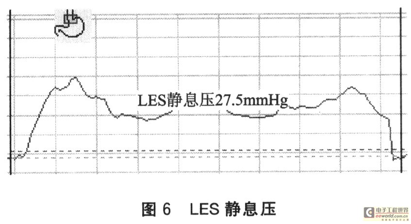 LES靜息壓