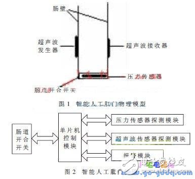 詳解智能人工肛門設(shè)計