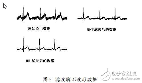 DIY自己的家庭電子醫療箱 軟硬件設計方案 （二）前置放大和抗干擾